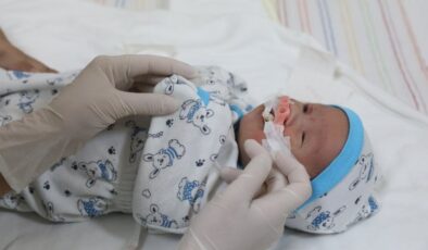 Dokuz Eylül dudak yarığı tedavisinde umut oluyor