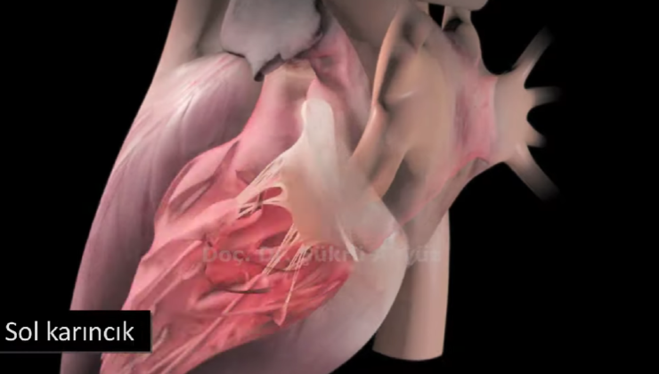 Mitral Darlık Nedir?